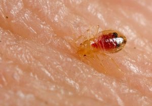red baby bed bug biting skin