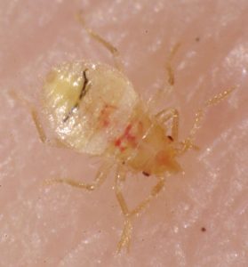 baby bed bug biting skin