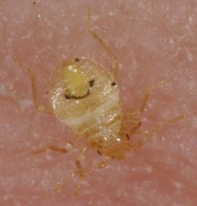 baby bed bug biting skin