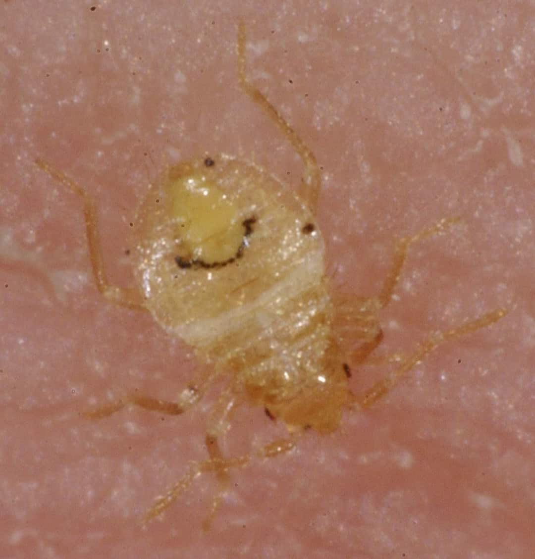 baby bed bugs