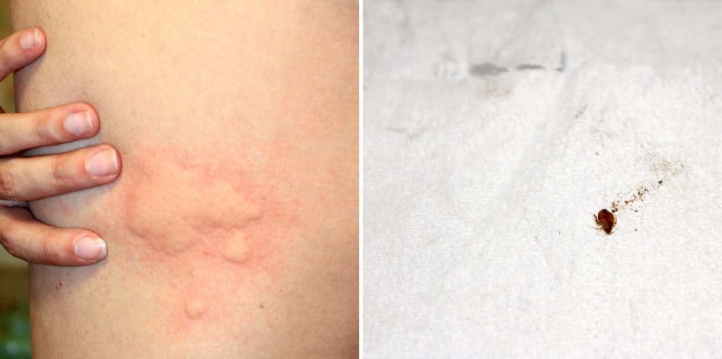 Rashes From Bed Bug Bites 2918