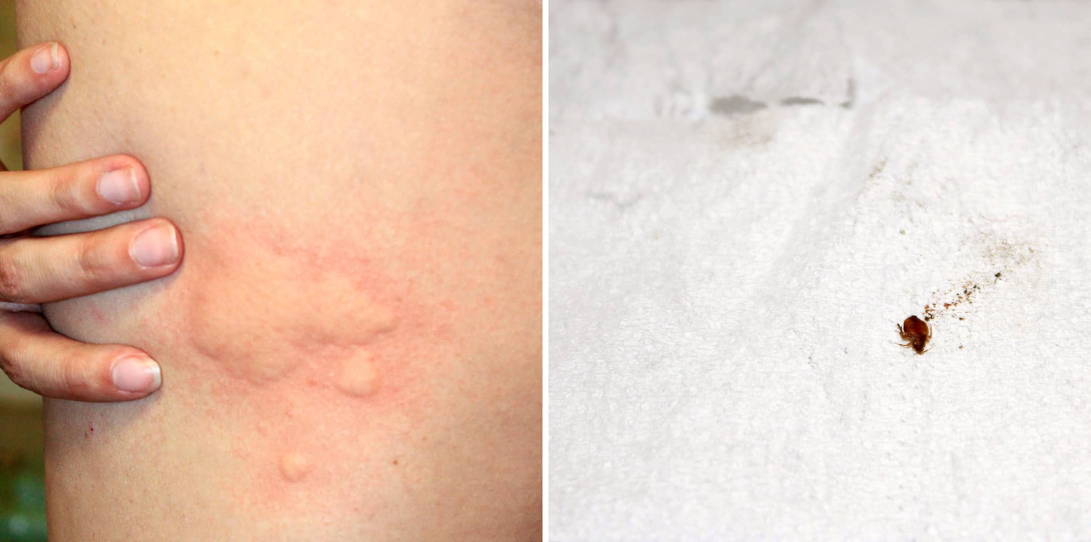 bug bites that itch more at night