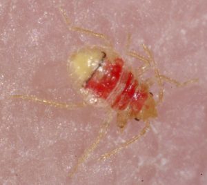 red baby bed bug biting